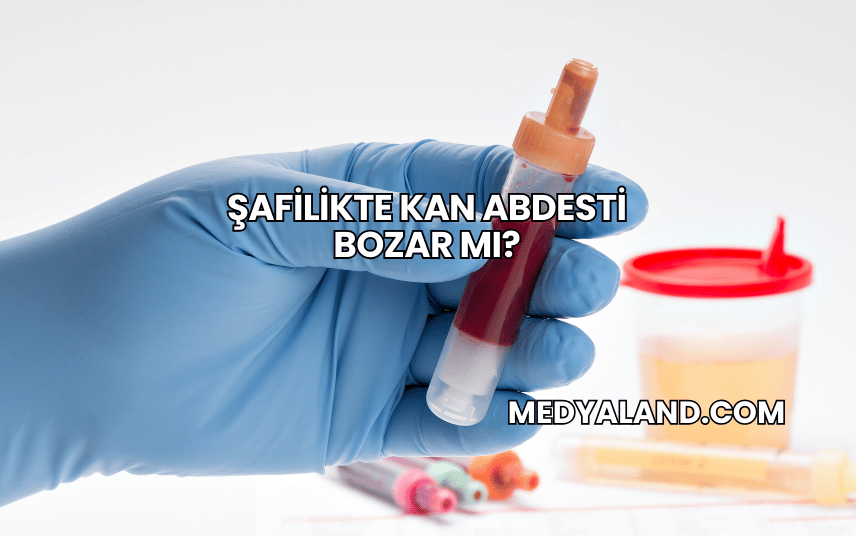 Şafilikte Kan Abdesti Bozar mı?