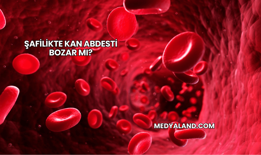 Şafilikte Kan Abdesti Bozar mı?