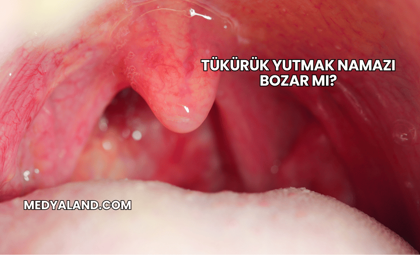 Tükürük Yutmak Namazı Bozar mı?